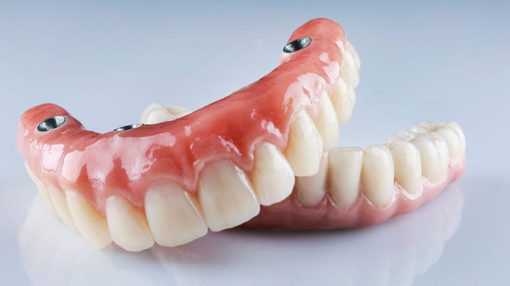 implant-retained dentures dental implants Chestnut Hill hybrid prosthesis
