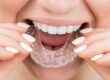 dental care near me clear aligners