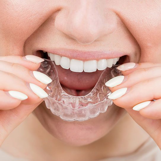 dental care near me clear aligners